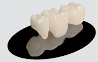 Emax Ceramic Trident Dental Lab