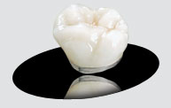 Porcelain Metal Restorations Crown from Trident Dental Lab at Hawthorne, CA