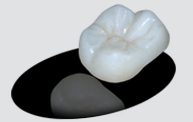 Triconia Layered Crown Zirconia Trident Dental Lab