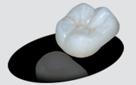 A Triconia Layered Crown Zirconia Trident Dental Lab at Hawthorne, CA