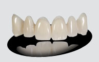 The Composite and Provisional TriTemps Trident.