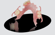 Explore denture and partials From Trident lab at Hawthorne, CA