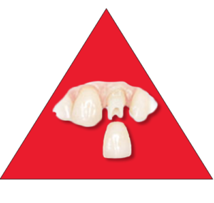 dental-lab-implants-abutments