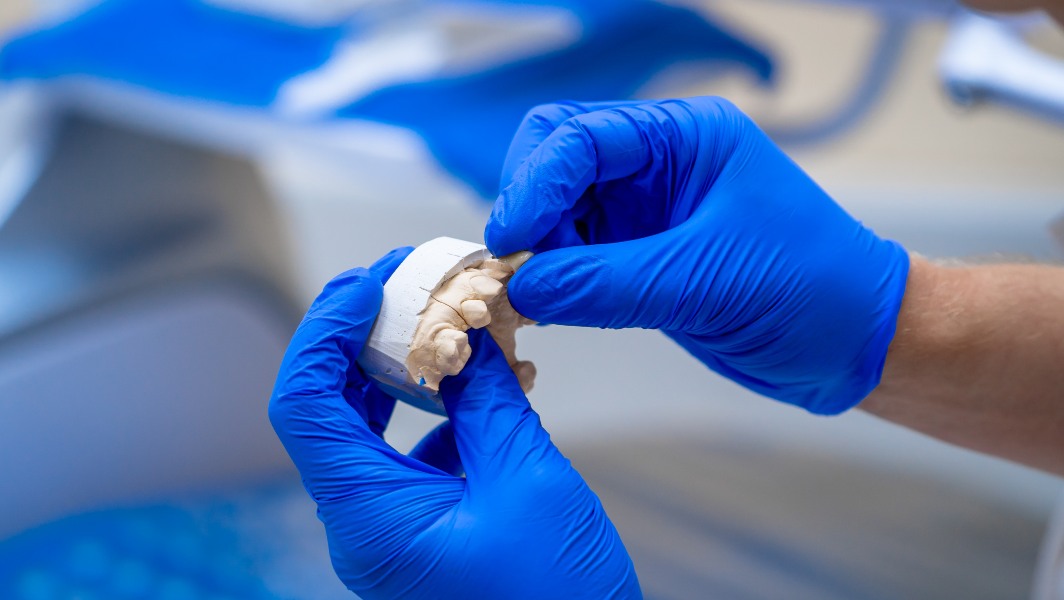 Zirconia Crowns Trident Dental Lab